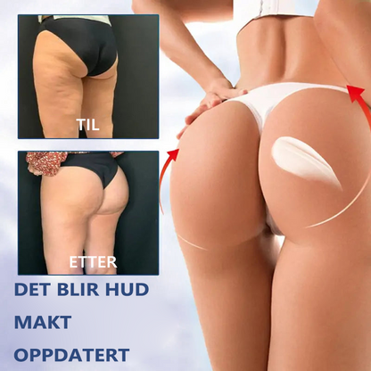 🍀🍀Siste dag rabatt: 80% rabatt🫧Fubsta® Avansert oppstrammende, rynke-reduserende krem: Gjenoppretter hudens elastisitet🫧