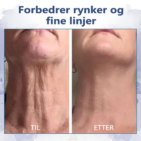 🍀🍀Siste dag rabatt: 80% rabatt🫧Fubsta® Avansert oppstrammende, rynke-reduserende krem: Gjenoppretter hudens elastisitet🫧