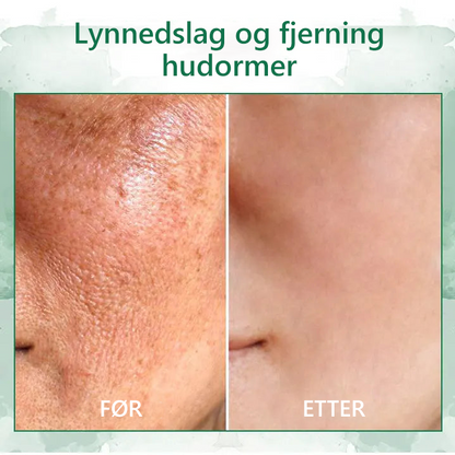 💧💧Siste dagskampanje 𝟕𝟎%𝐎𝐅𝐅 - ✨𝐅𝐮𝐛𝐬𝐭𝐚™ hudoppstrammende foryngende serum✨